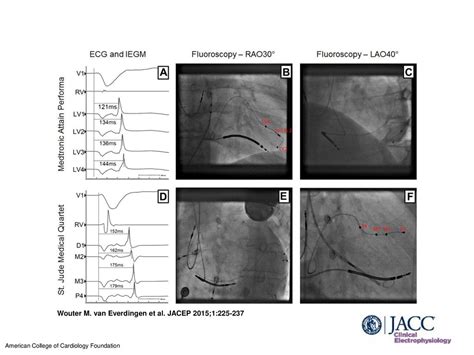 quartet cardiology.